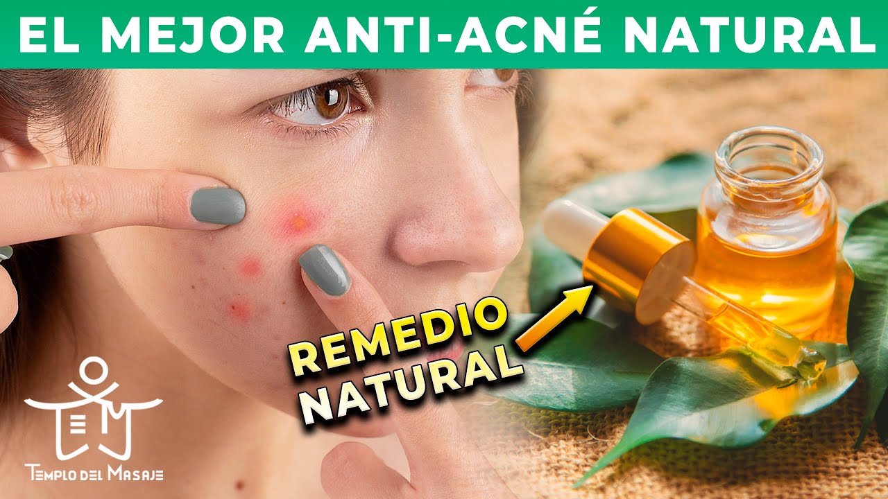 arbol de te para el acne