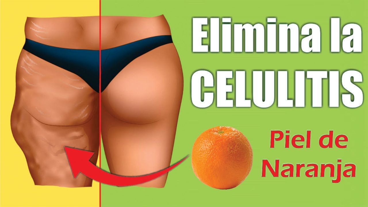 como quitar la piel de naranja en las piernas
