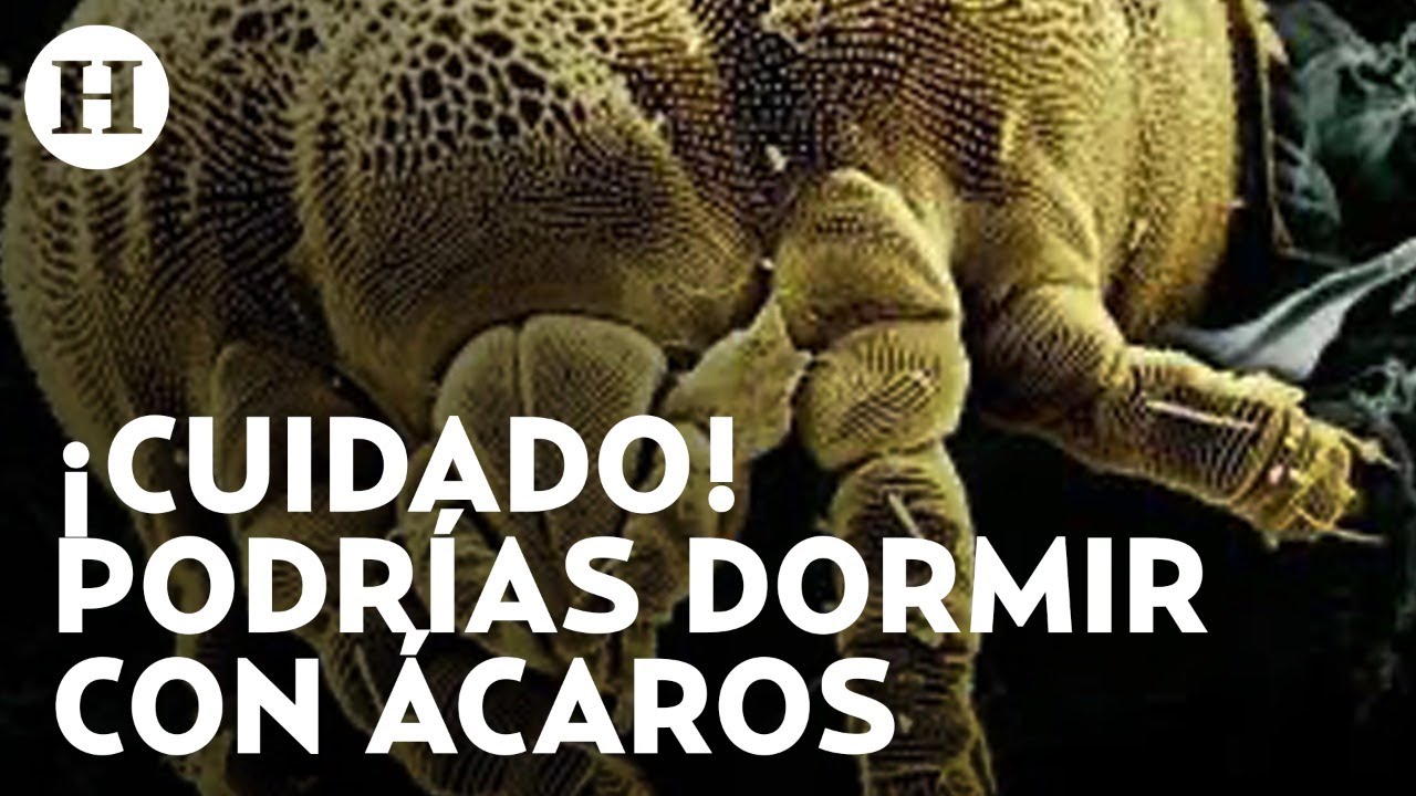 como se si mi cama tiene acaros