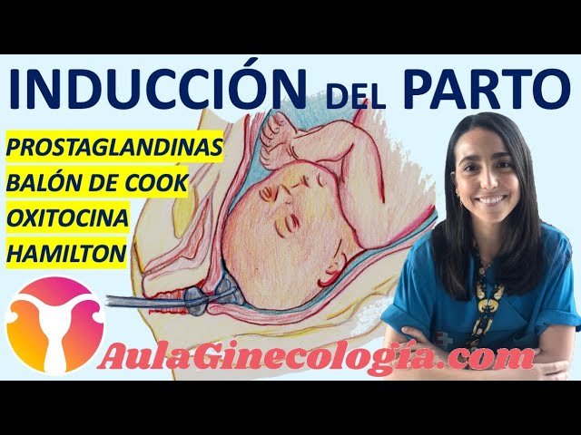 para que ponen oxitocina en el parto