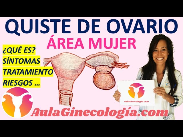 quiste de 5 centimetros en ovario