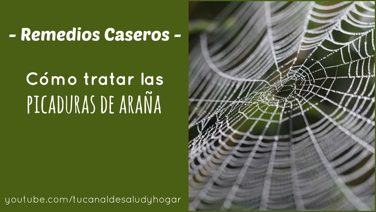 vinagre para las picaduras de araña