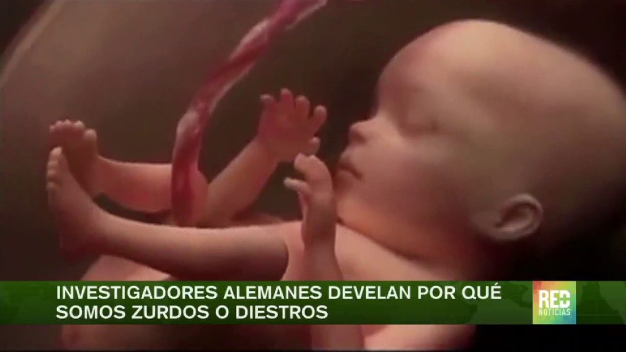 consecuencias de obligar a un zurdo a ser diestro