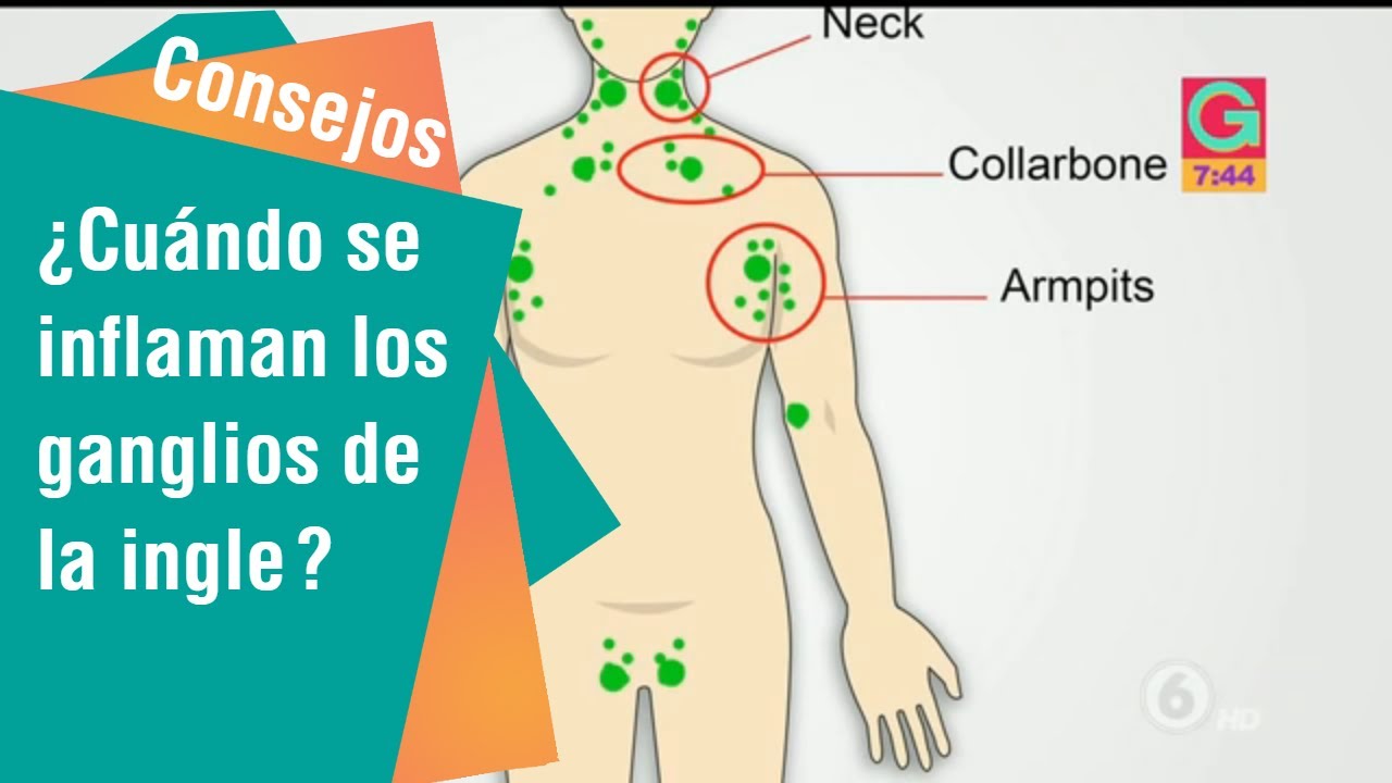 me ha salido un bulto en la ingle