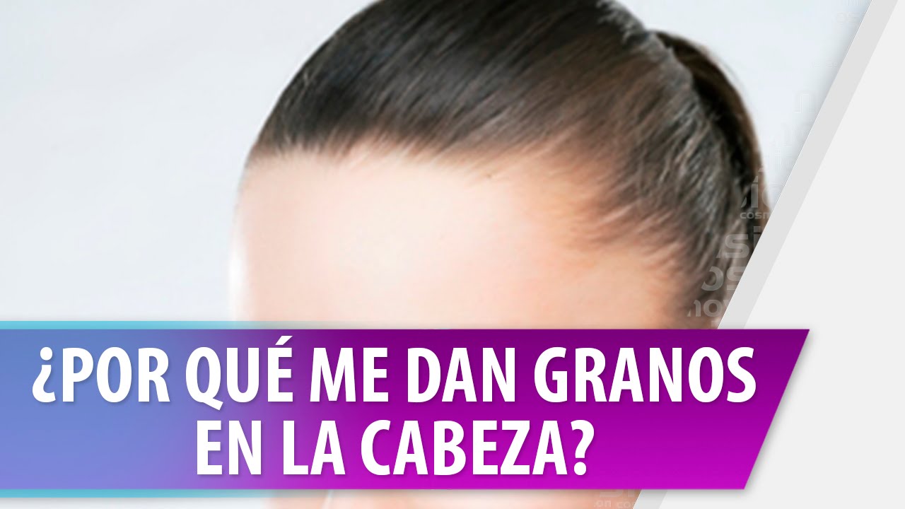 me salio un granito en la cabeza