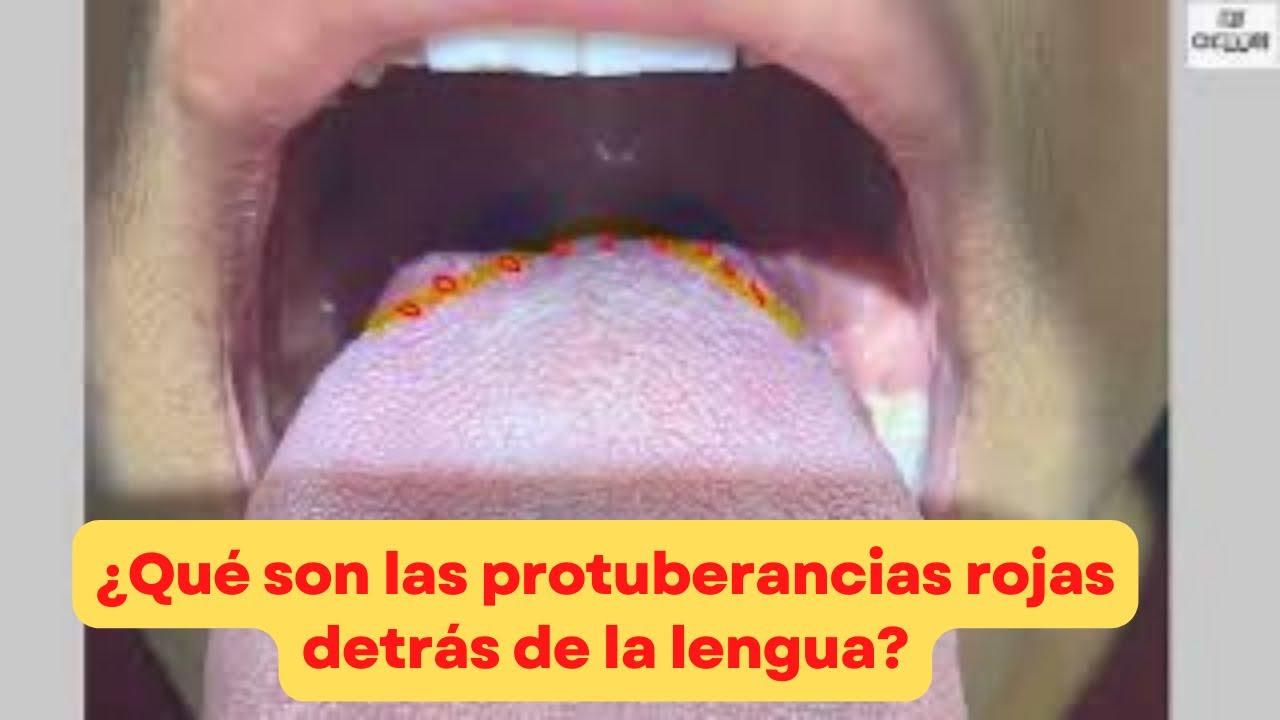 papilas gustativas grandes al final de la lengua