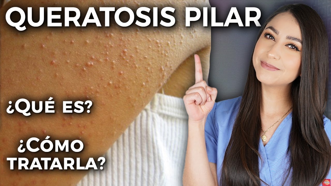 piel de gallina solo en una parte del cuerpo