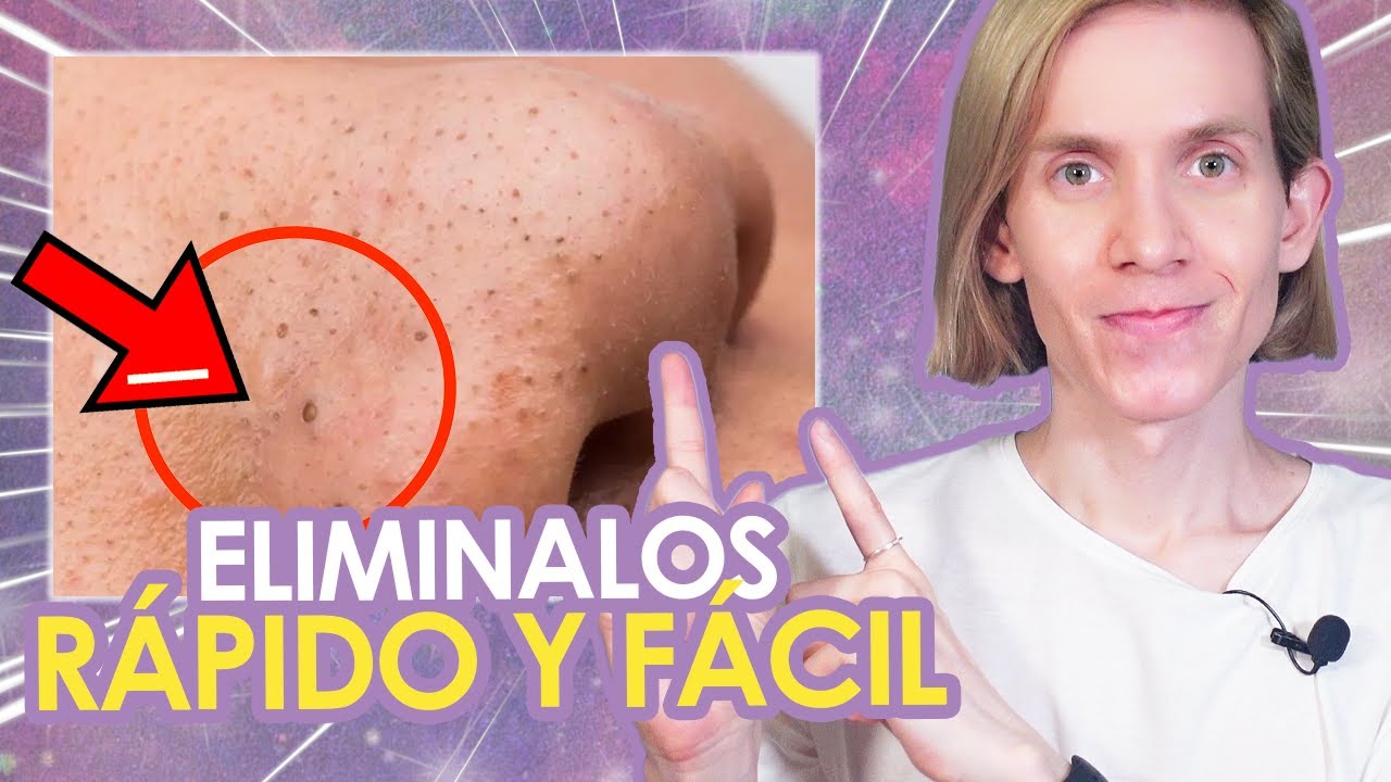 producto para quitar puntos negros de la nariz