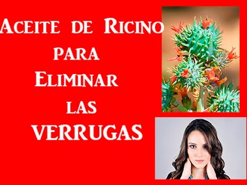 aceite de ricino para las verrugas