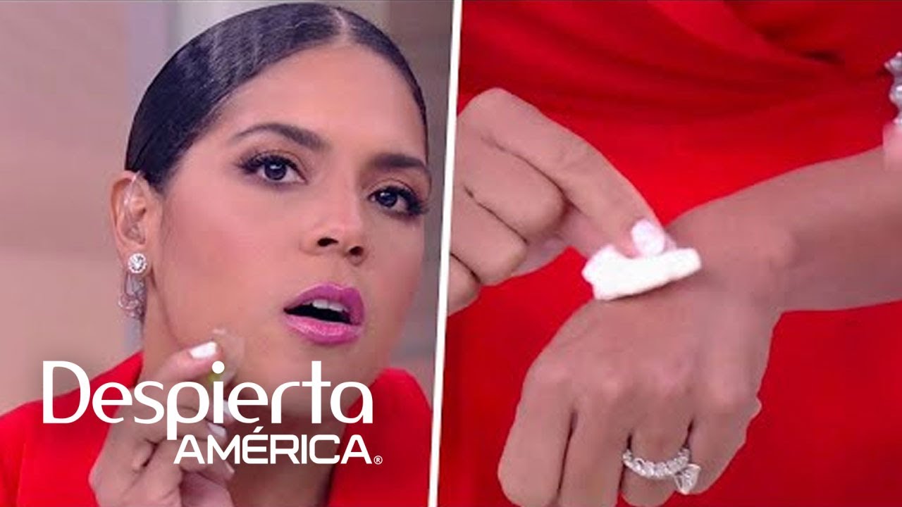 como quitar manchas de granos naturalmente