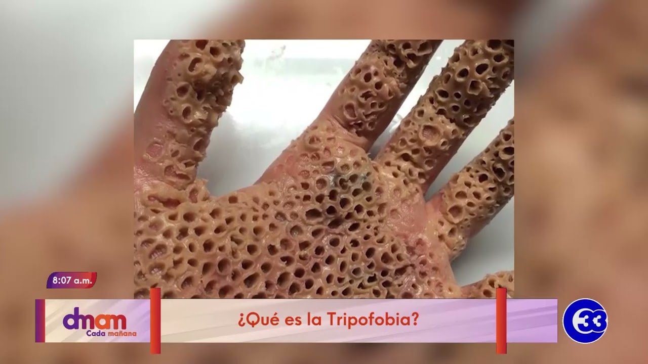 fobia a los agujeros en la piel