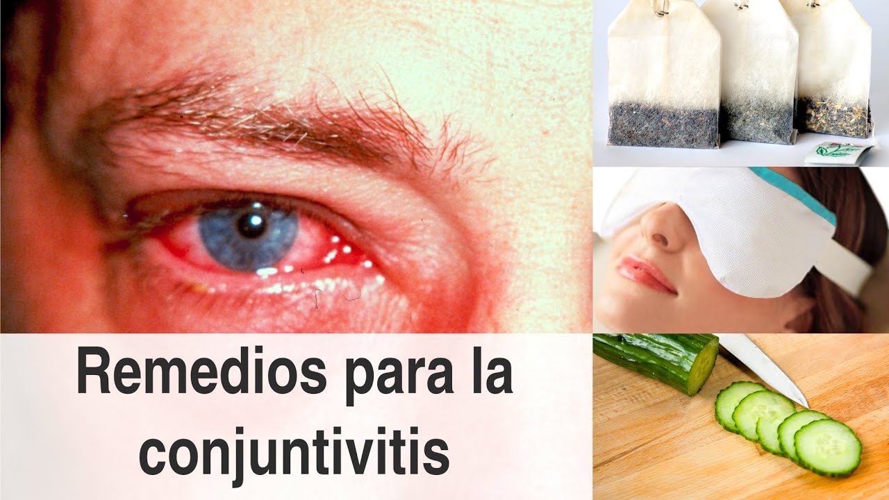 gotas para conjuntivitis niños sin receta