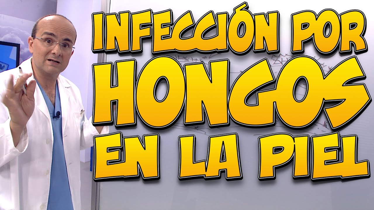 manchas rojas hongos en la piel