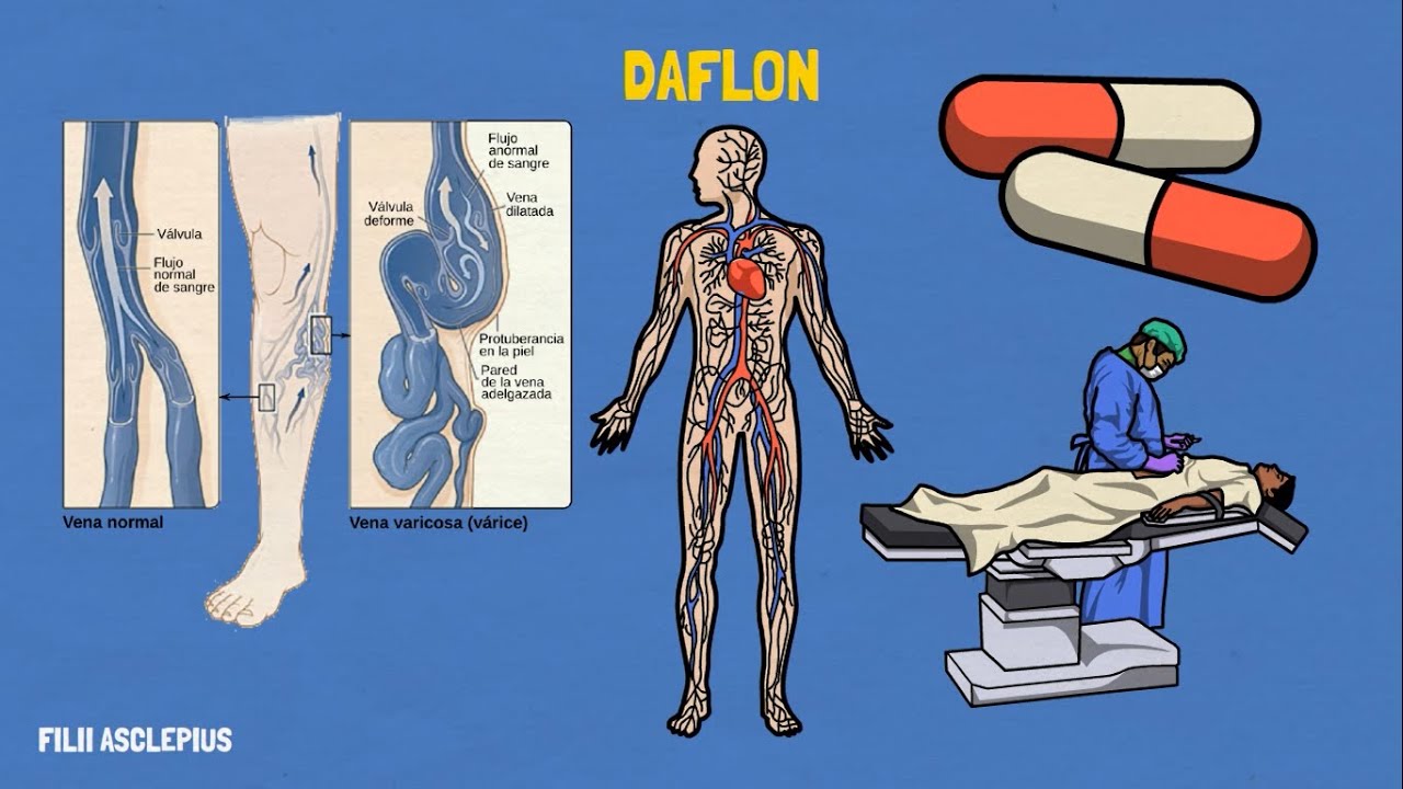 qué es daflon y para qué sirve