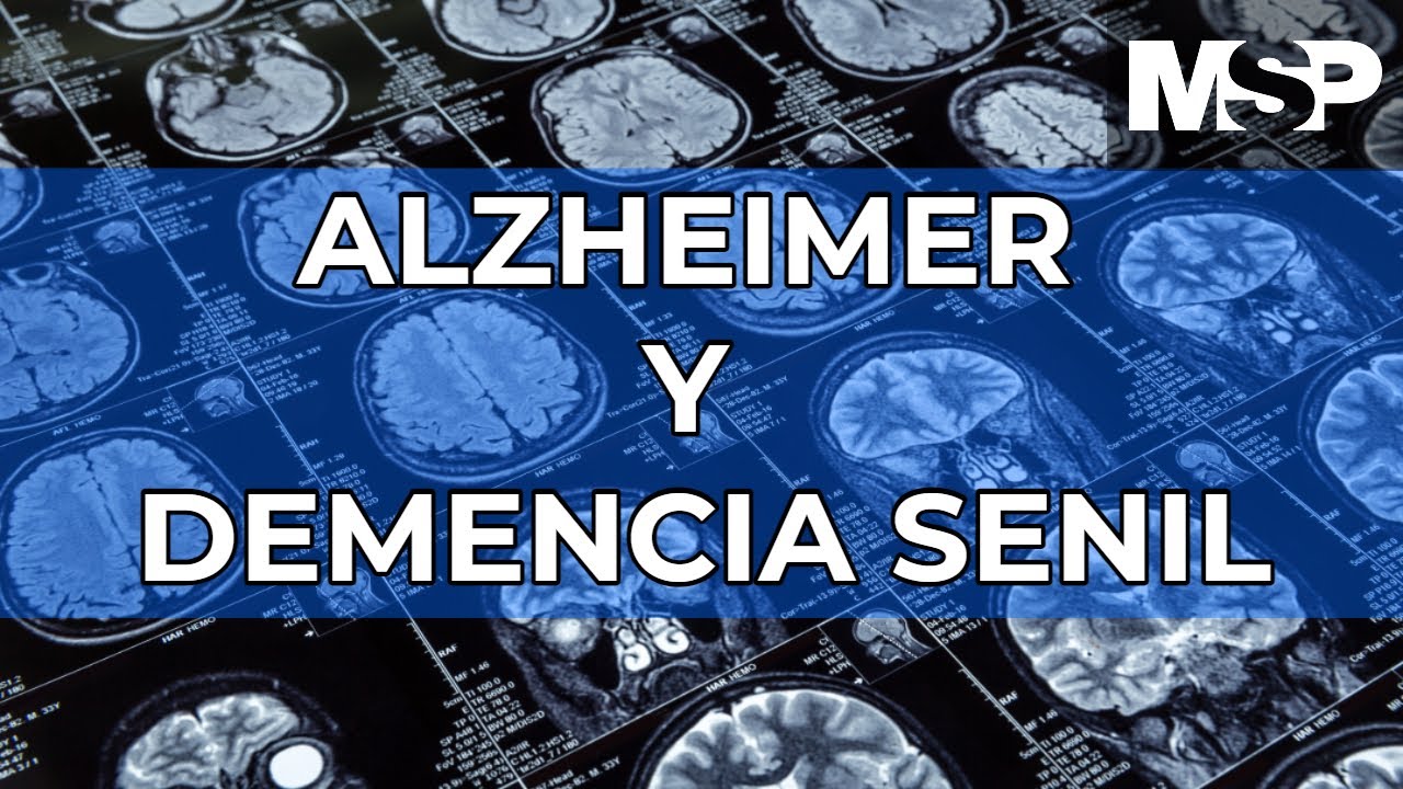 se puede tener alzheimer y parkinson a la vez