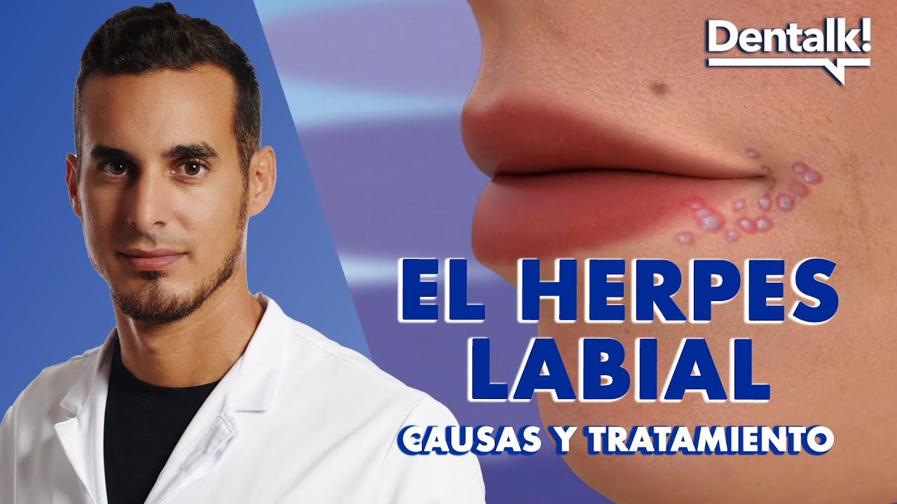 como quitar las calenturas de los labios