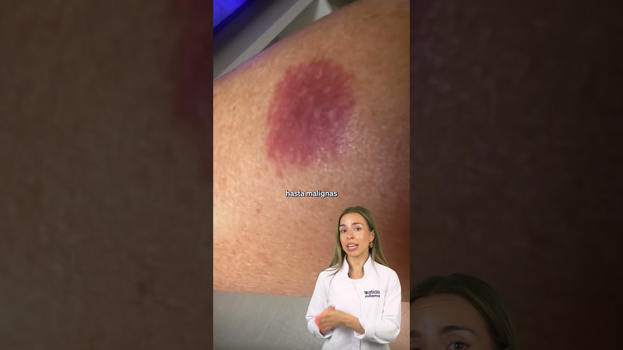 manchas rojas en el cuerpo a que se debe