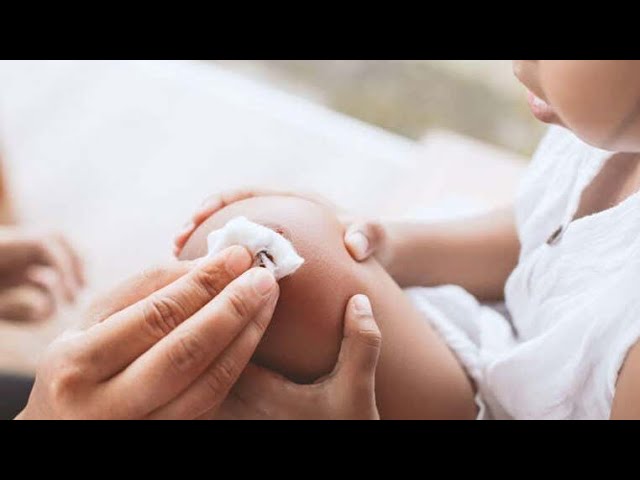 porque hace espuma el agua oxigenada