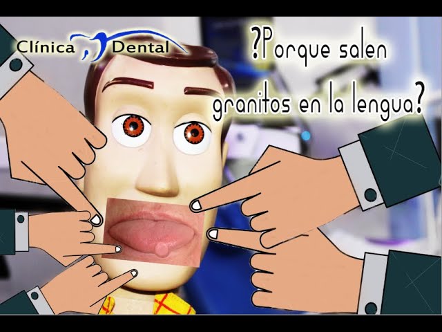 porque salen los sapos en la lengua