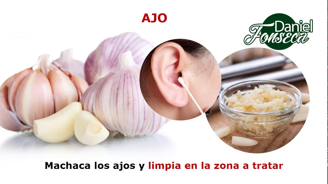 remedios caseros para el zumbido en el oído