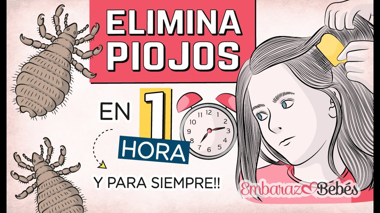 como eliminar los piojos de forma casera