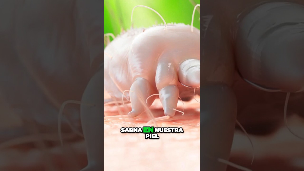 cremas para la sarna sin receta