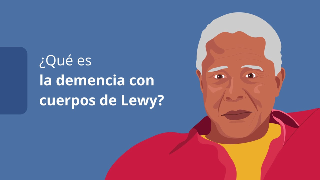 demencia con cuerpos de lewy fases