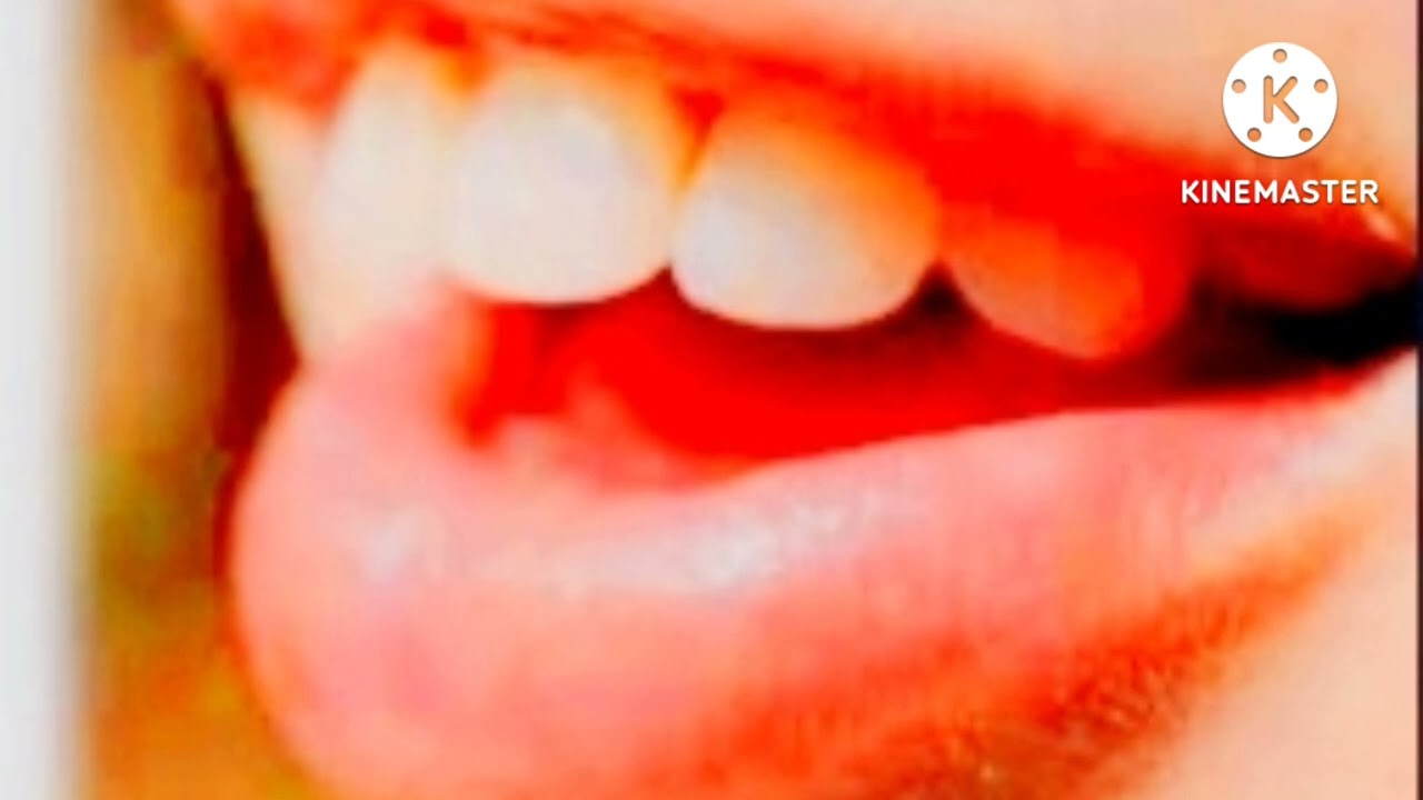 soñar que se me mueven los dientes